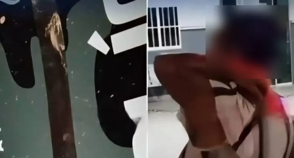  Esposa ataca marido com facão após descobrir amante