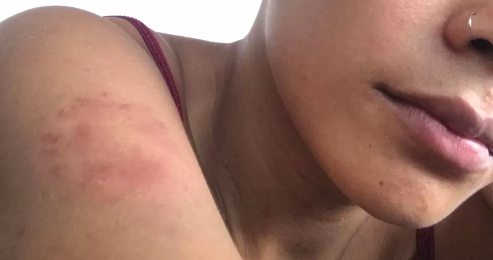 Mulher é espancada pelo marido após descobrir traição em Porto Velho