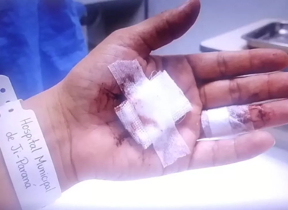 Mulher é esfaqueada pela companheira em caso de violência doméstica em Ji-Paraná