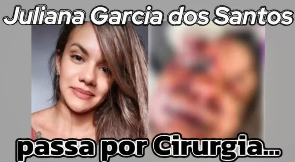 Vítima de espancamento em elevador teve lesão como se sofresse acidente de moto sem capacete